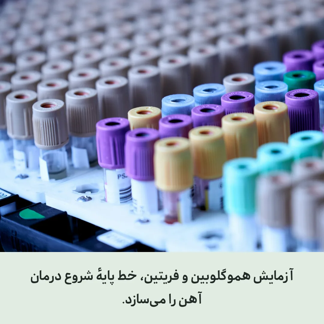 لوله‌های آزمایش نمونه خون در آزمایشگاه