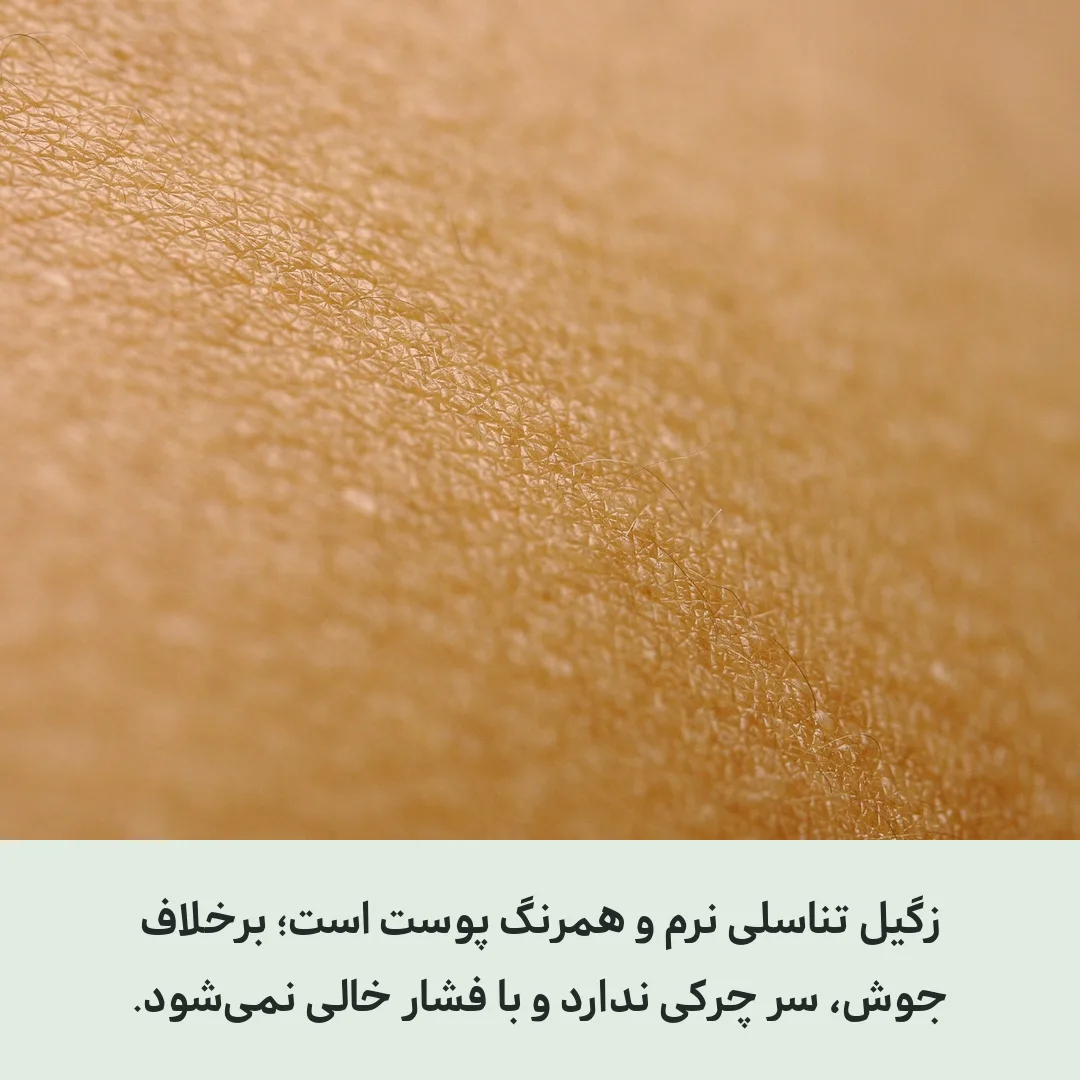 نمای نزدیک پوست