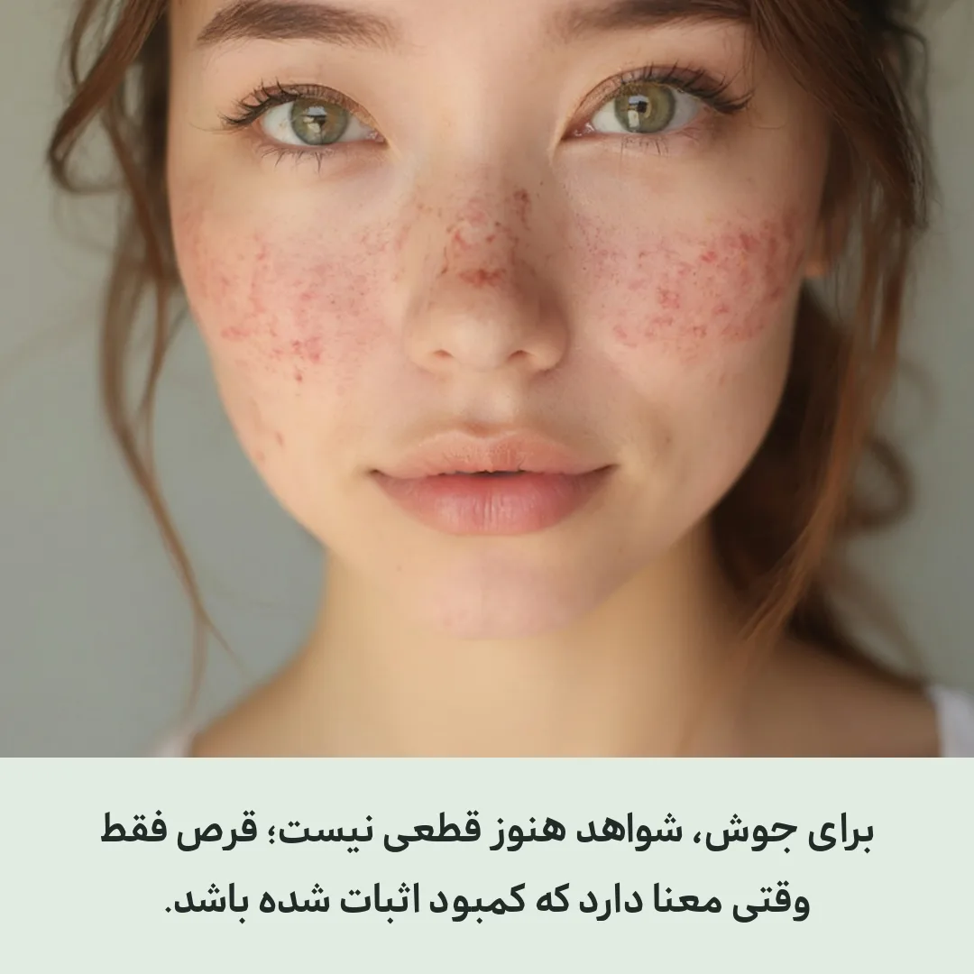 قرص ویتامین دی برای جوش صورت